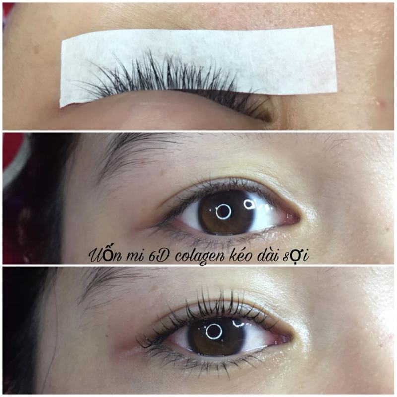 Thẩm mỹ viện Khánh Ngân