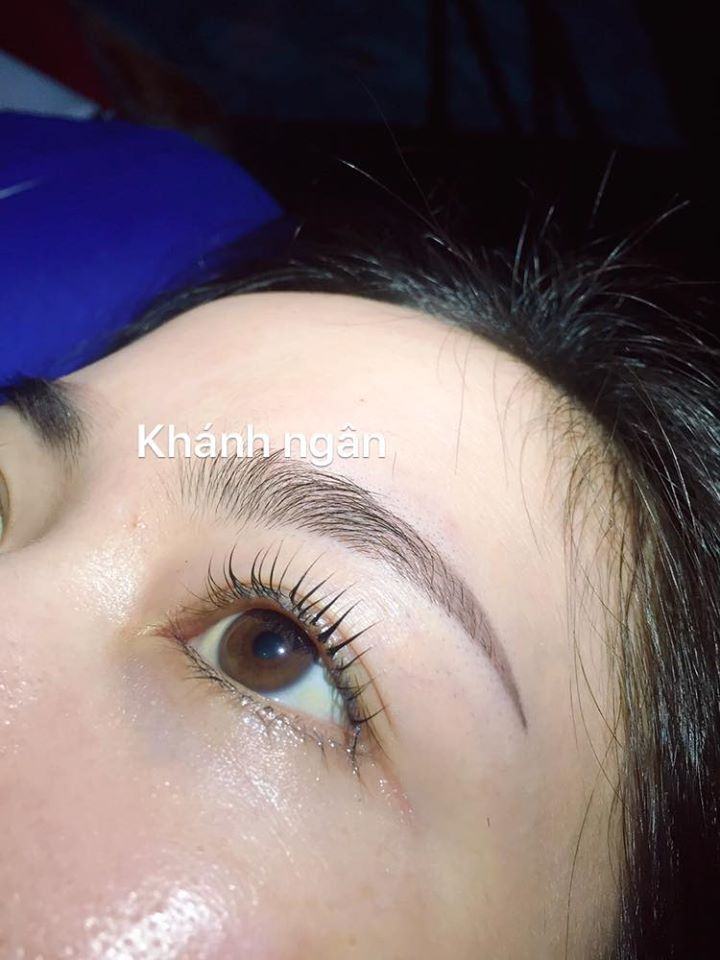 Thẩm mỹ viện Khánh Ngân