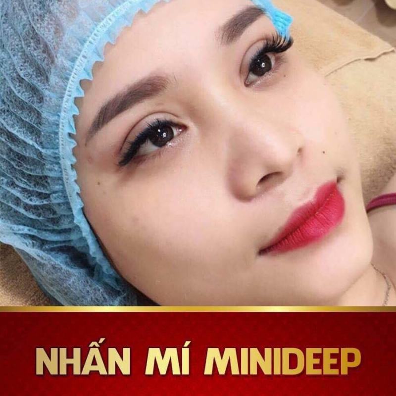 Bấm nắp Hồ Ly