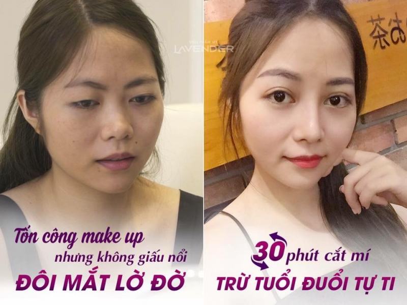 Thẩm mỹ viện Trần Trà