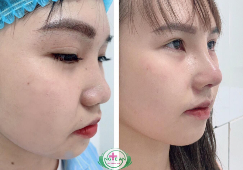 Trung tâm phẫu thuật thẩm mỹ - Bệnh viện Ba Lan