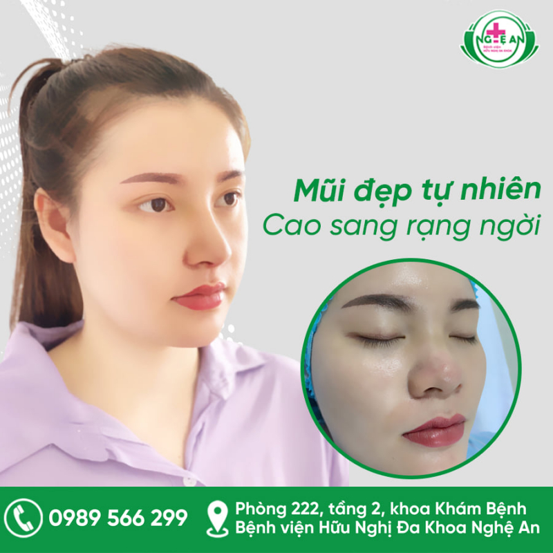 Trung tâm phẫu thuật thẩm mỹ - Bệnh viện Ba Lan