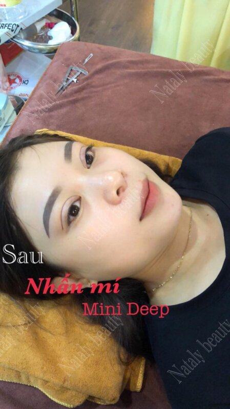 Thẩm mỹ viện công nghệ cao Nataly