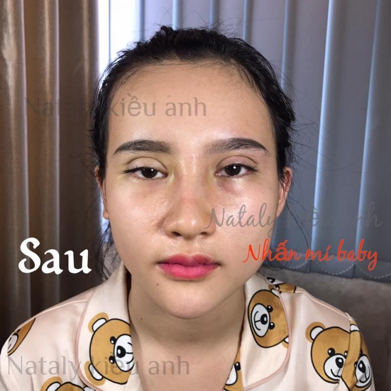 Thẩm mỹ viện công nghệ cao Nataly